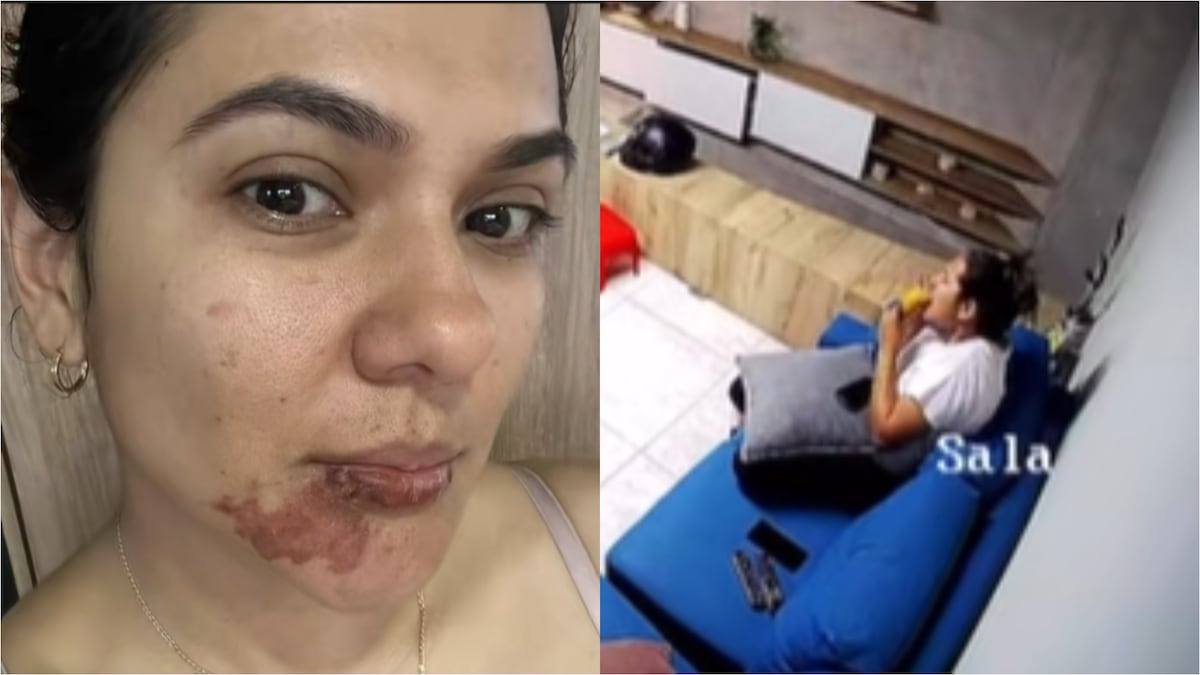 Video: mujer terminó con quemaduras luego de que una empanada le explotara en la cara Video: mujer terminó con quemaduras luego de que una empanada le explotara en la cara